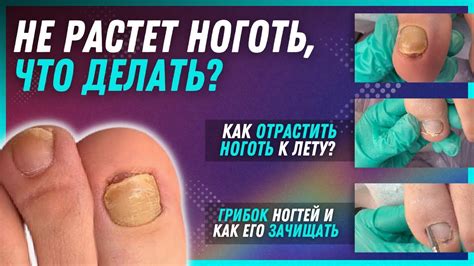 Мне больно, когда ноготь растет