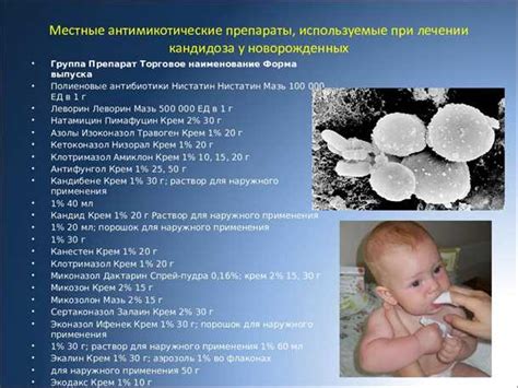 Молочница у новорожденных: причины и особенности