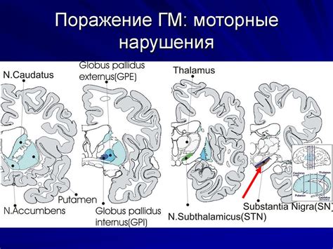 Моторные нарушения