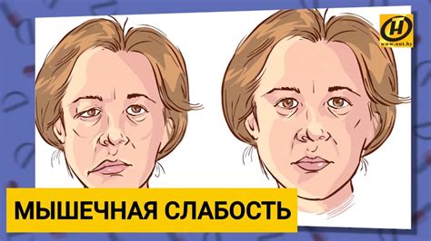 Мышечная слабость и расслабление животных мышц