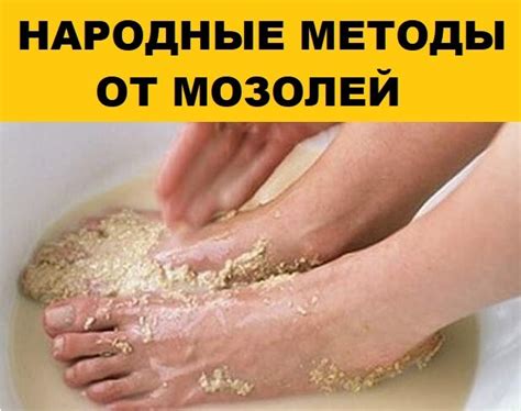 Народные рецепты избавления от мозолей