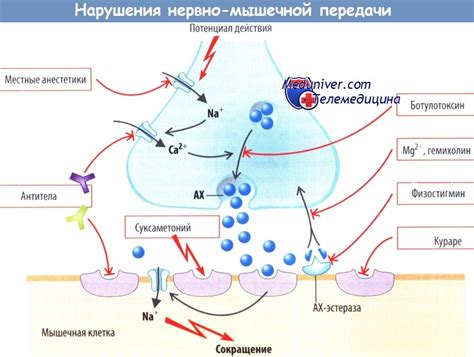 Нарушение механизмов нервно-мышечной сигнализации