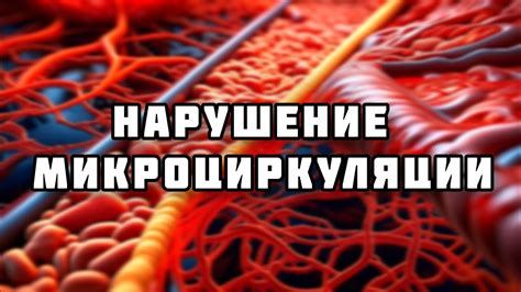 Нарушение микроциркуляции