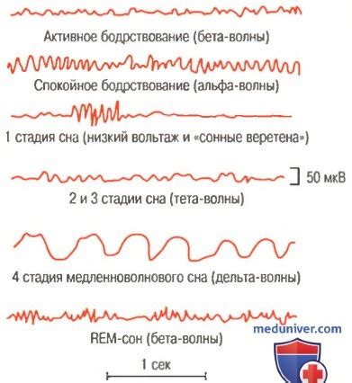 Нарушение моторной активности во время сна