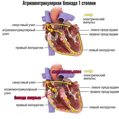 Нарушение работы механизмов