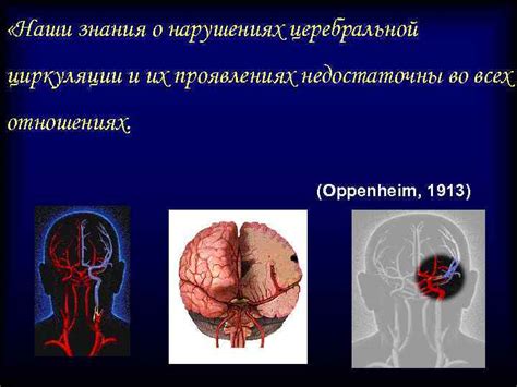 Нарушение церебральной циркуляции