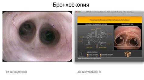 Настройка программы для работы с эндоскопом