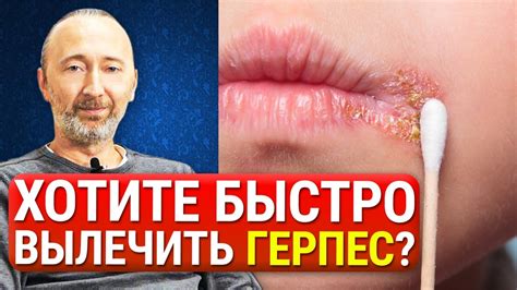 Натуральные методы удаления папилломы с глаза: отрубевые маски и масла