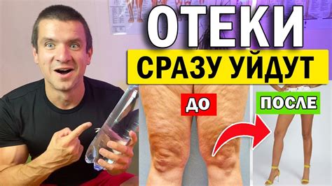 Натуральные способы осветления кожи между ног