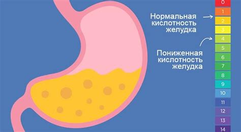 Научные факты о влиянии йогурта на кислотность желудка