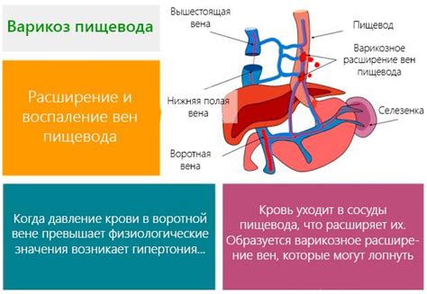 Недостаточное объемовое расширение пищевода