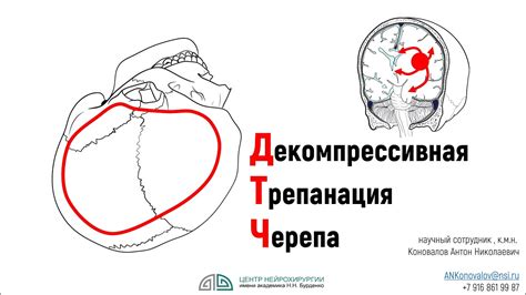 Недостаточное прочищение отверстий наушников