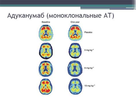 Нейробиологические особенности эмоционального опыта