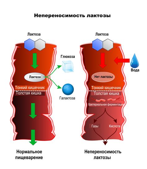 Непереносимость и причины