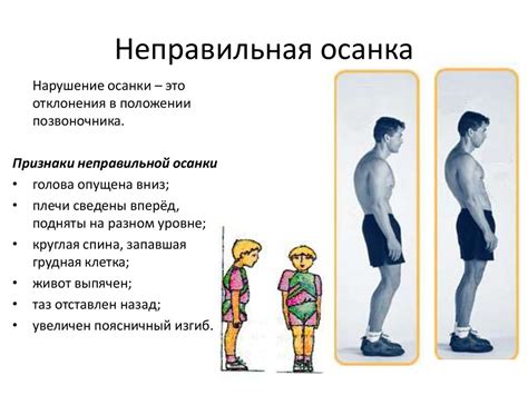 Неправильная осанка и слабые мышцы