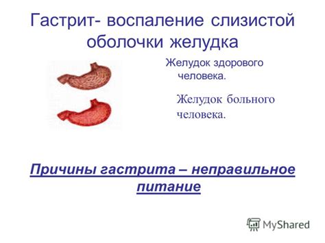 Неправильное питание и раздражение слизистой оболочки