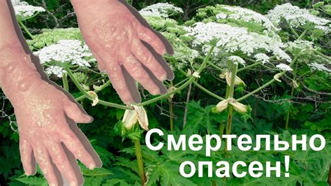 Неправильное применение средства вызывает ожоги