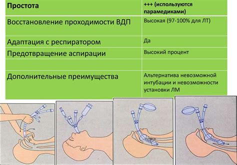 Обеспечение доступа кислорода для восстановления проходимости дыхательных путей