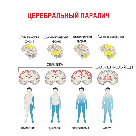 Обломовы: паралич неразумной лени