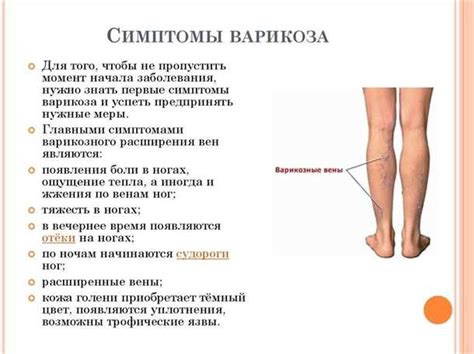 Общие рекомендации по устранению отеков на животе