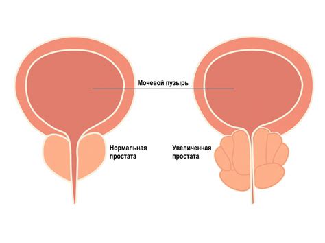 Овуляционная дисфункция: причины и способы улучшения