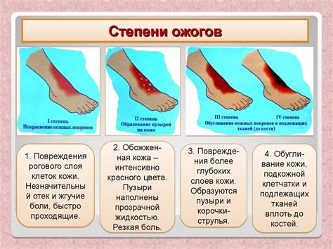 Ожоги горячей пищей и напитками