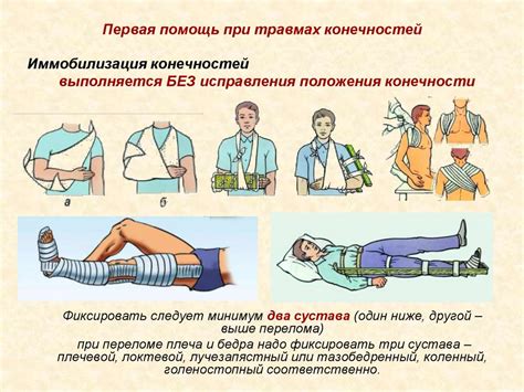 Оказание первой помощи при повреждениях конечностей