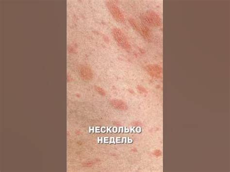 Околофизические причины невидимости розового