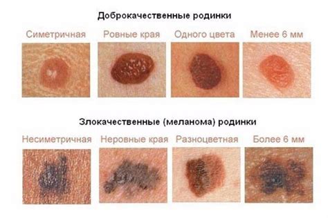 Опасности, связанные с паутинкой на коже или волосах