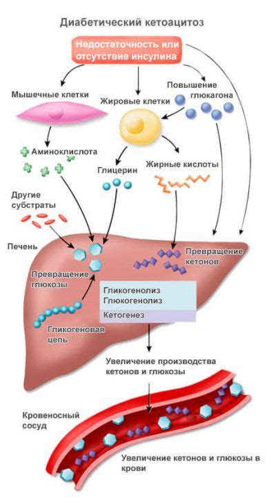 Опасность №1: Кетоацидоз