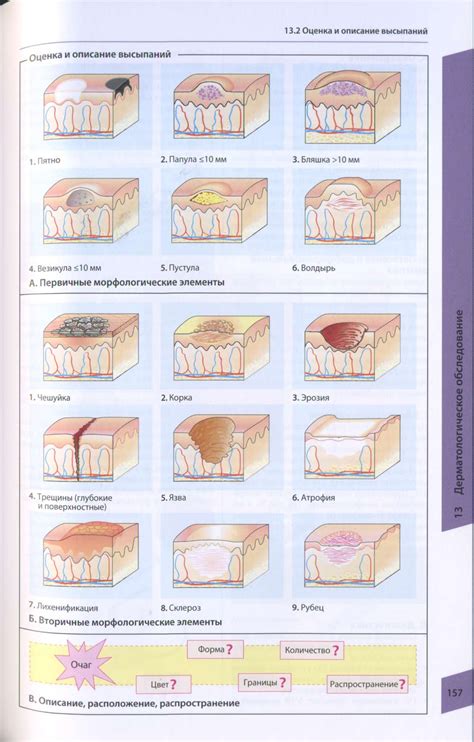 Описание сыпи на коже и ее влияние на организм