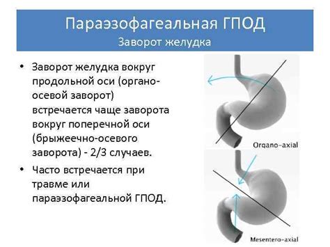 Определение диафрагмы