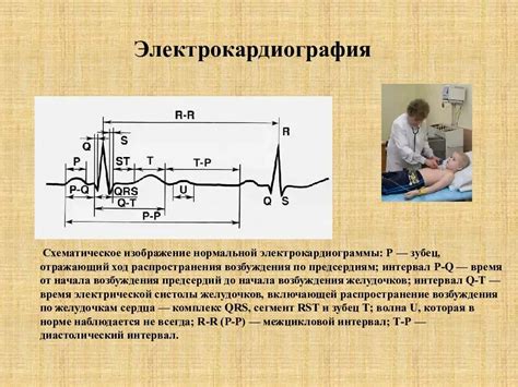 Определение и цель электрокардиограммы