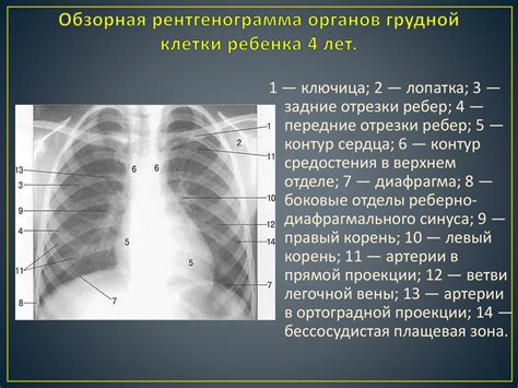 Определение основных элементов на рентгенограмме