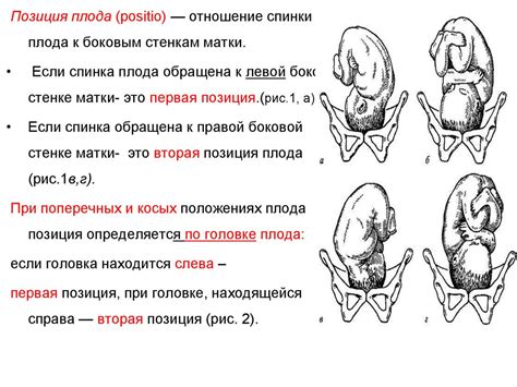 Определение позиции плода