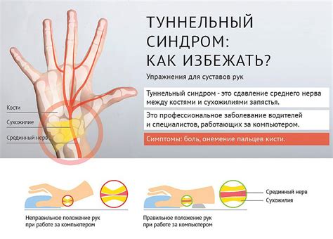 Определение причин немоты пальцев левой руки