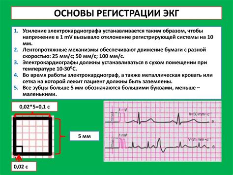 Определение ритма на ЭКГ: основы и методы