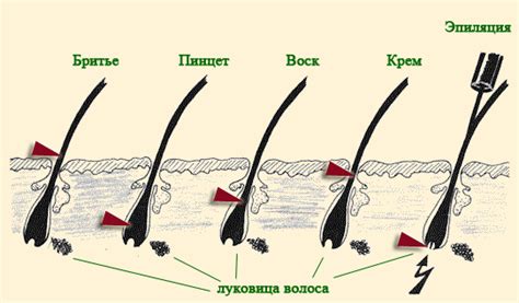 Оптимальное время удаления волос в интимной зоне