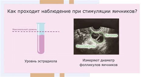 Оптимизация процесса стимуляции овуляции