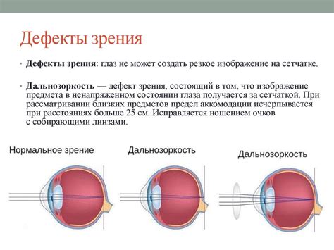 Оптические свойства глаза