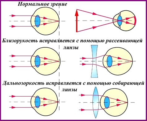 Оптические системы глаза