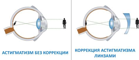 Оптические средства: очки и контактные линзы