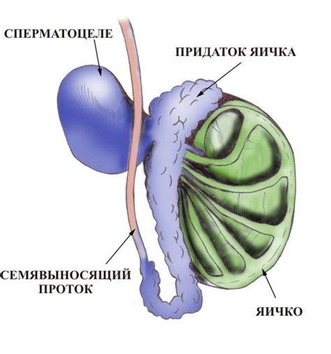 Опухоль левого яичка у мужчины: возможные симптомы