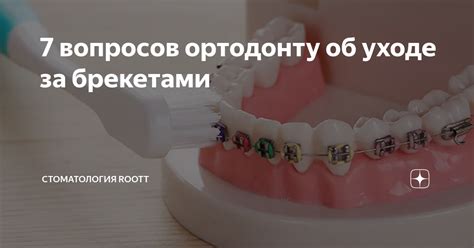 Опытные отзывы о уходе за брекетами