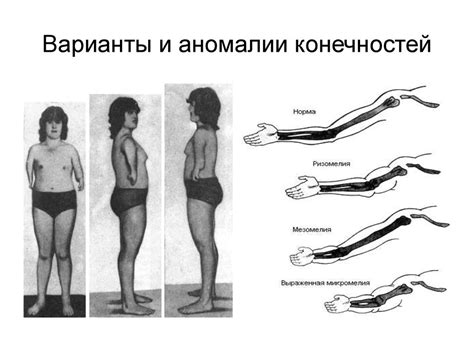 Освойте базовые принципы отображения туловища и конечностей