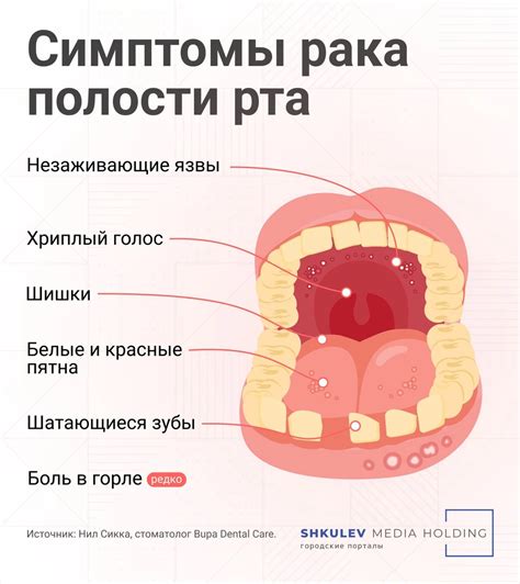 Ослабление мышц гортани и языка