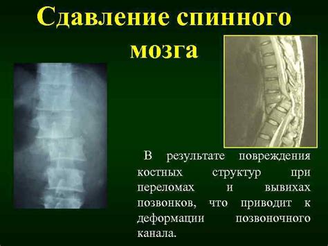 Ослабление опорных структур позвоночника