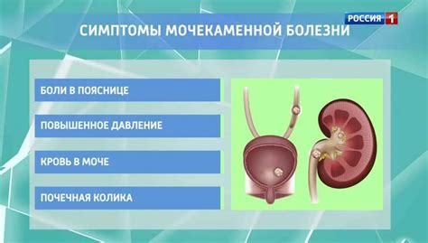 Осложнения, вызванные оксалатами в моче