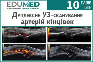 Осложнения и противопоказания ультразвукового дуплексного сканирования брахицефальных артерий