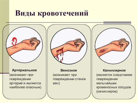 Осложнения кровотечения при приеме воды